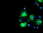 SLFNL1 Antibody in Immunocytochemistry (ICC/IF)
