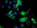 SLFNL1 Antibody in Immunocytochemistry (ICC/IF)