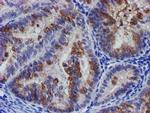 SLFNL1 Antibody in Immunohistochemistry (Paraffin) (IHC (P))