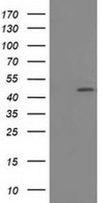 SLFNL1 Antibody in Western Blot (WB)
