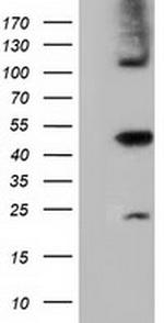 SLFNL1 Antibody in Western Blot (WB)