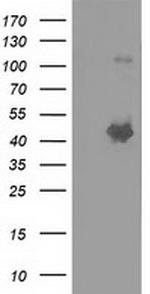 SLFNL1 Antibody in Western Blot (WB)