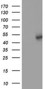 SLFNL1 Antibody in Western Blot (WB)