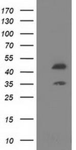 SLFNL1 Antibody in Western Blot (WB)