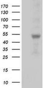 SLFNL1 Antibody in Western Blot (WB)