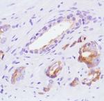 SLIT2 Antibody in Immunohistochemistry (IHC)
