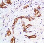 SLIT2 Antibody in Immunohistochemistry (IHC)