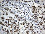 SLU7 Antibody in Immunohistochemistry (Paraffin) (IHC (P))
