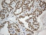 SLU7 Antibody in Immunohistochemistry (Paraffin) (IHC (P))