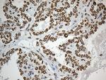 SLU7 Antibody in Immunohistochemistry (Paraffin) (IHC (P))