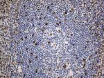 SLU7 Antibody in Immunohistochemistry (Paraffin) (IHC (P))
