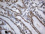 SLU7 Antibody in Immunohistochemistry (Paraffin) (IHC (P))