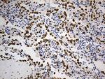 SLU7 Antibody in Immunohistochemistry (Paraffin) (IHC (P))