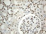 SLU7 Antibody in Immunohistochemistry (Paraffin) (IHC (P))