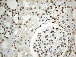 SLU7 Antibody in Immunohistochemistry (Paraffin) (IHC (P))