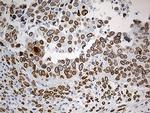 SLU7 Antibody in Immunohistochemistry (Paraffin) (IHC (P))