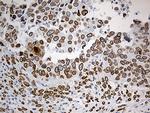 SLU7 Antibody in Immunohistochemistry (Paraffin) (IHC (P))