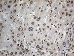 SLU7 Antibody in Immunohistochemistry (Paraffin) (IHC (P))