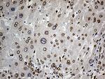 SLU7 Antibody in Immunohistochemistry (Paraffin) (IHC (P))