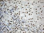 SLU7 Antibody in Immunohistochemistry (Paraffin) (IHC (P))