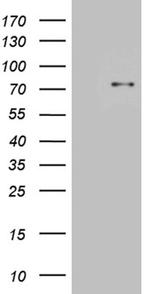 SLU7 Antibody in Western Blot (WB)