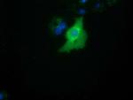 SMAD2 Antibody in Immunocytochemistry (ICC/IF)