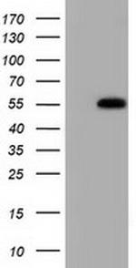 SMAD2 Antibody in Western Blot (WB)