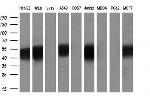 SMAD2 Antibody in Western Blot (WB)