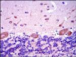 SMAD2 Antibody in Immunohistochemistry (Paraffin) (IHC (P))