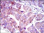 SMAD2 Antibody in Immunohistochemistry (Paraffin) (IHC (P))