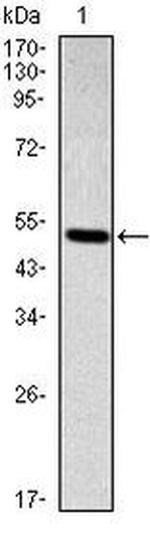 SMAD2 Antibody in Western Blot (WB)