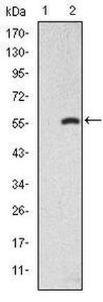 SMAD2 Antibody in Western Blot (WB)