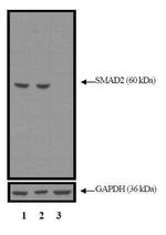 SMAD2 Monoclonal Antibody (G.392.2)