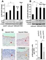 SMAD3 Antibody in Western Blot (WB)