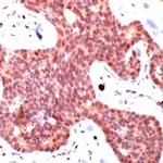 SMAD3 Polyclonal Antibody