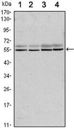 SMAD6 Monoclonal Antibody (5H3)