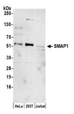 SMAP1 Polyclonal Antibody