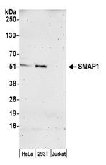 SMAP1 Polyclonal Antibody