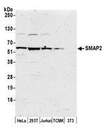 SMAP2 Polyclonal Antibody