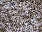 SMAP2 Antibody in Immunohistochemistry (Paraffin) (IHC (P))