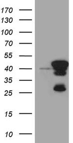 SMAP2 Antibody in Western Blot (WB)