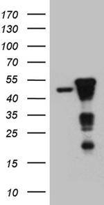SMAP2 Antibody in Western Blot (WB)