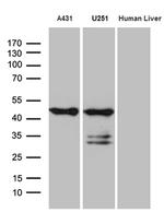 SMAP2 Antibody in Western Blot (WB)