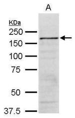 SMARCC2 Antibody in Western Blot (WB)