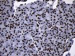SMC1A Antibody in Immunohistochemistry (Paraffin) (IHC (P))