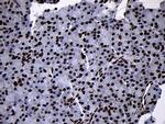 SMC1A Antibody in Immunohistochemistry (Paraffin) (IHC (P))