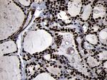 SMC1A Antibody in Immunohistochemistry (Paraffin) (IHC (P))