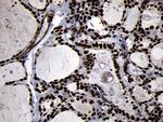 SMC1A Antibody in Immunohistochemistry (Paraffin) (IHC (P))