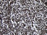 SMC1A Antibody in Immunohistochemistry (Paraffin) (IHC (P))