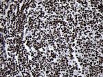 SMC1A Antibody in Immunohistochemistry (Paraffin) (IHC (P))